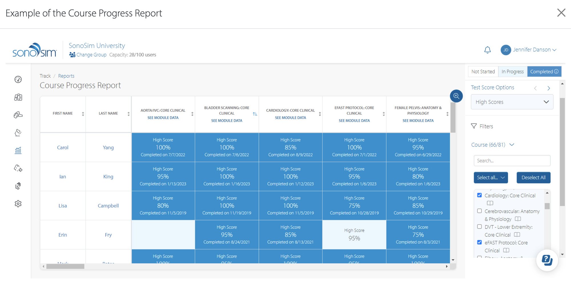 SonoSim Performance Tracker contains summary reports as shown