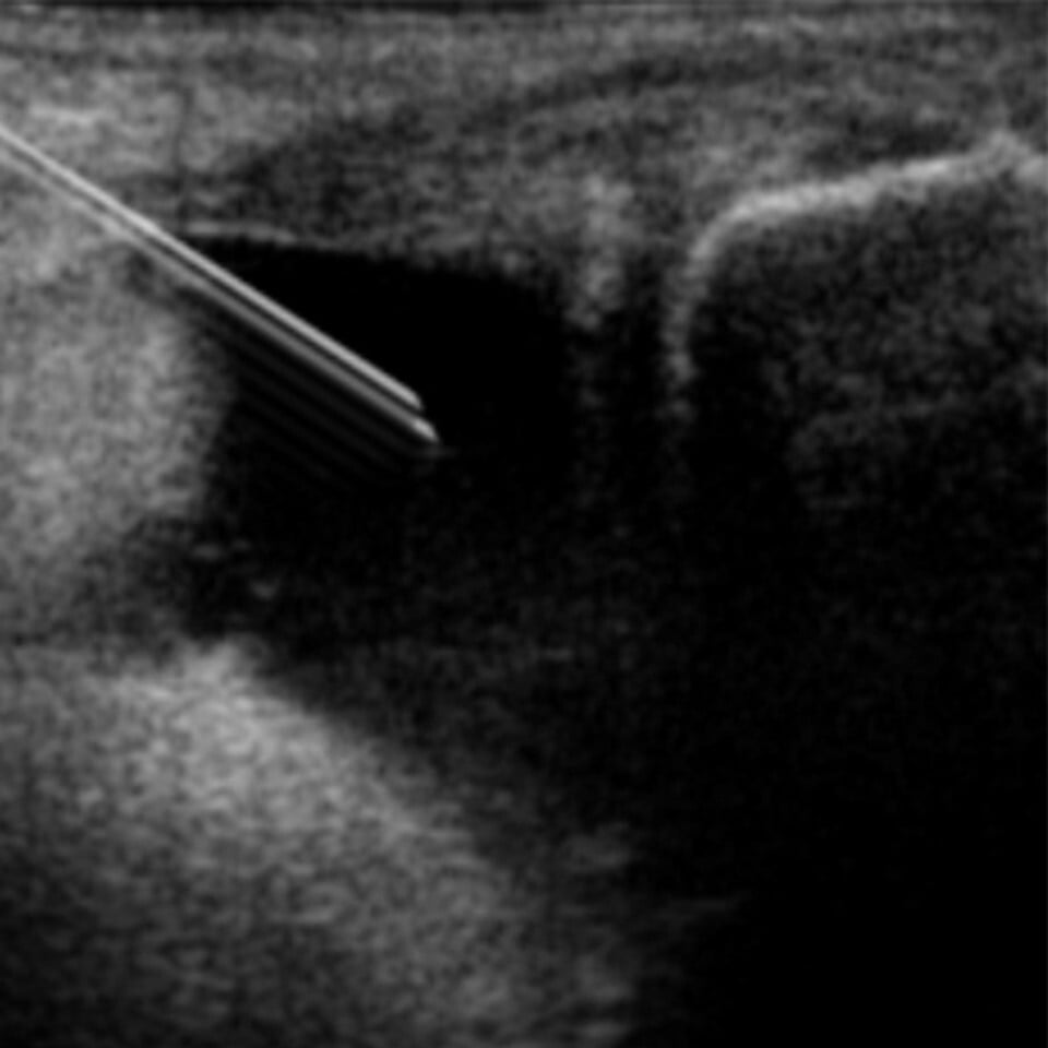 Ultrasound_Image_Knee_Joint_IA__65268