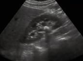 Urology and nephrology ultrasound image