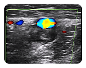 Vascular technology ultrasound image for training DMS on demand