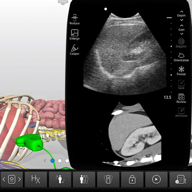 adrenal_glands_case_screen__59202 adrenal_glands_case_screen__59202