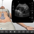 GYN Ultrasound of Nonpregnant Abnormal Uterus Part 1