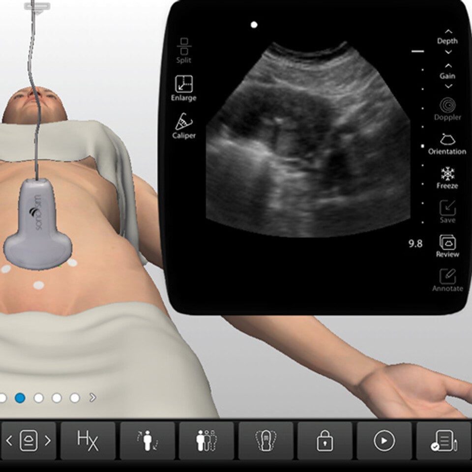 adv_abnormal_uterus1_case_screen__80865 adv_abnormal_uterus1_case_screen__80865