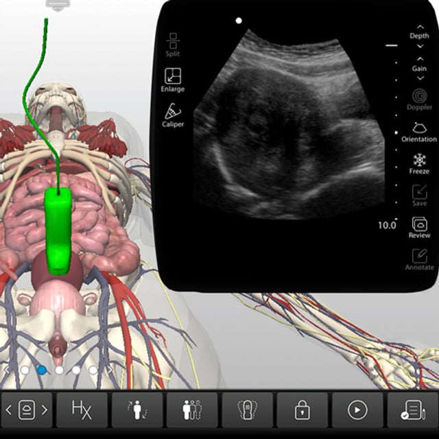adv_abnormal_uterus2_case_screen__02909-1 adv_abnormal_uterus2_case_screen__02909-1