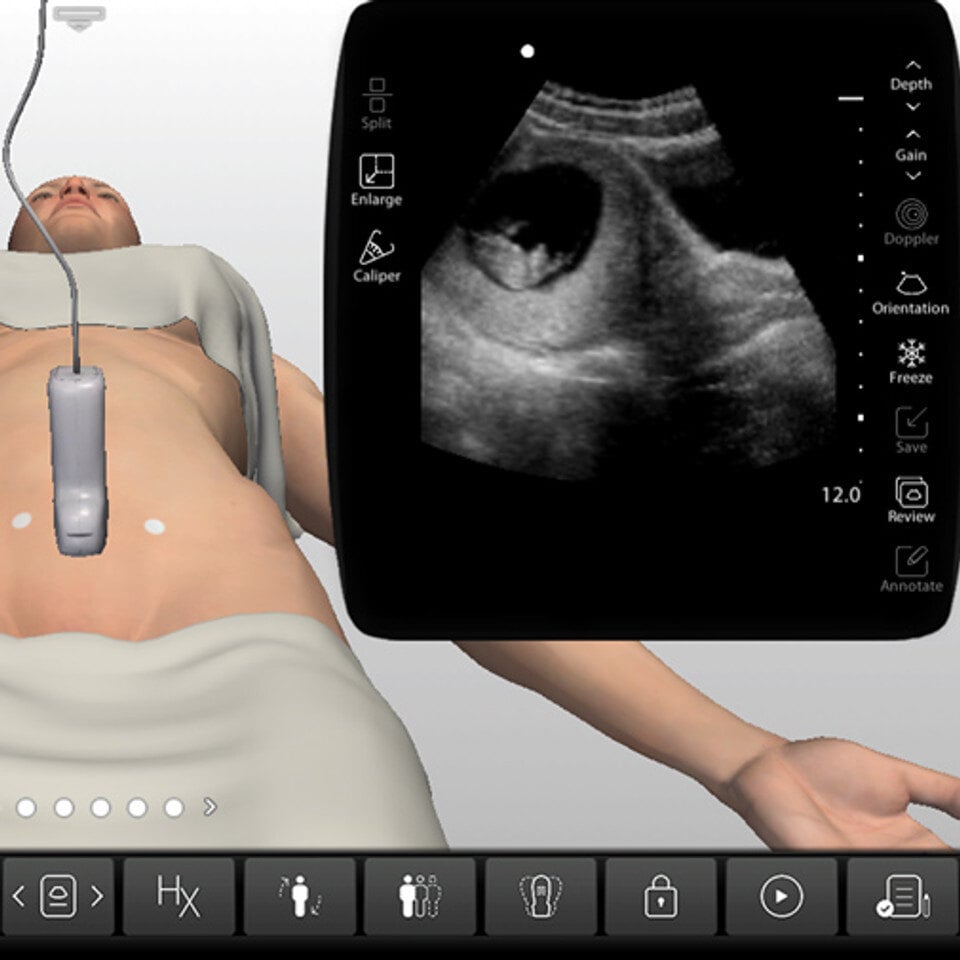 adv_first_trimester_case_screen__64461-1 adv_first_trimester_case_screen__64461-1