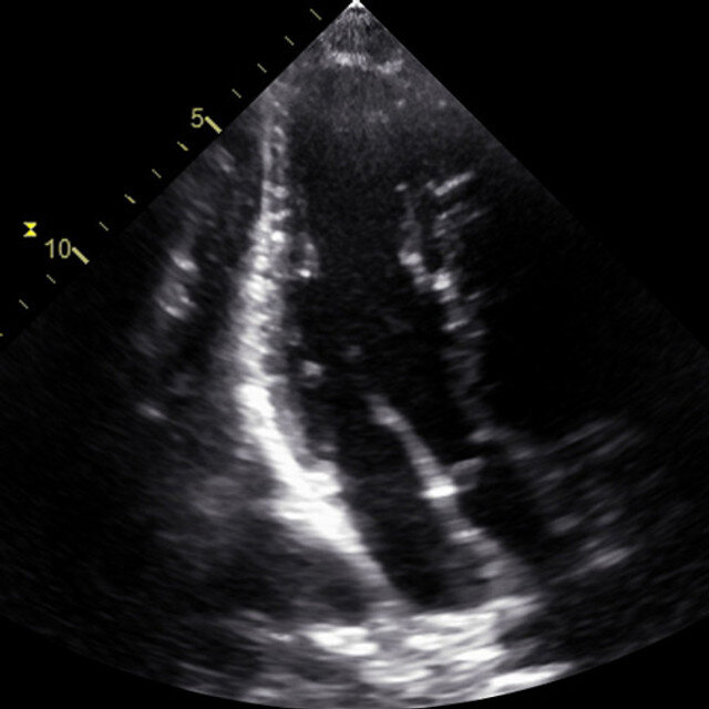 adv_focus1_ultrasound__06253-1