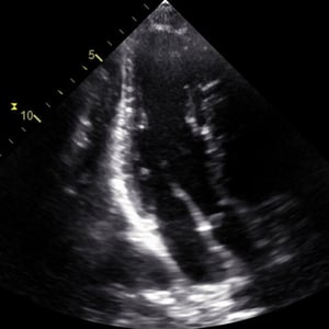 adv_focus1_ultrasound__06253-1 adv_focus1_ultrasound__06253-1