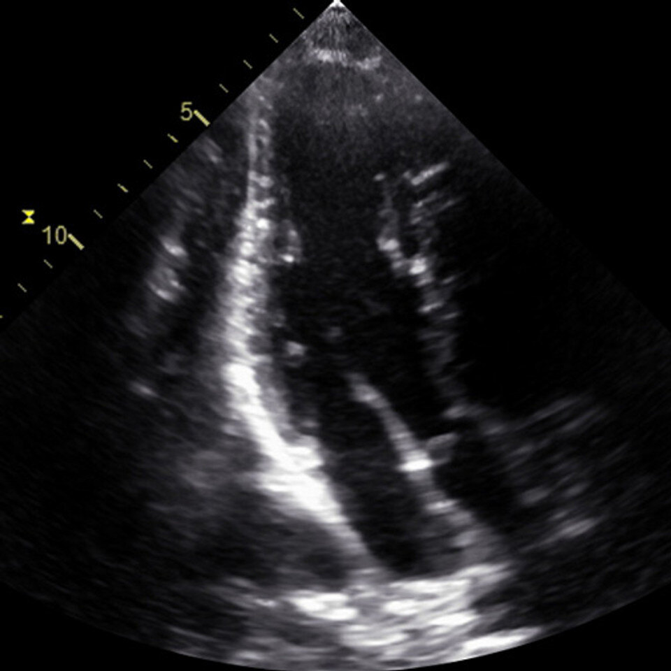 adv_focus1_ultrasound__06253-2