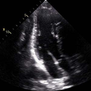 adv_focus1_ultrasound__06253-2 adv_focus1_ultrasound__06253-2