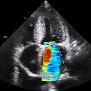 adv_focus2_ultrasound__69302 adv_focus2_ultrasound__69302