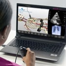 LVAD Problem-Focused Echocardiography