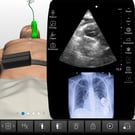 LVAD Problem-Focused Echocardiography