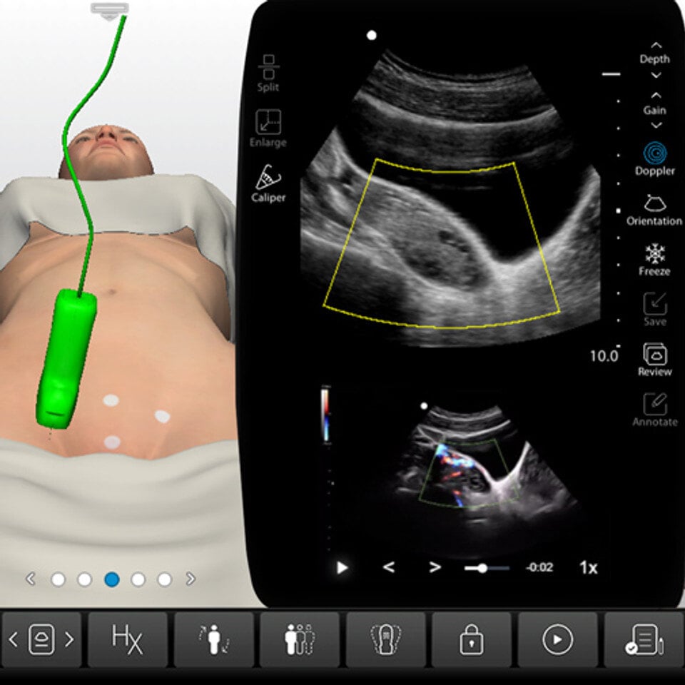 adv_malignant_adnexa_case_screen__43006 adv_malignant_adnexa_case_screen__43006
