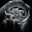 Image of Neonatal & Infant Neurosonography, part of SonoSim's Advanced Clinical Series in ultrasound training