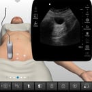 GYN Ultrasound Nonmalignant Adnexal Conditions