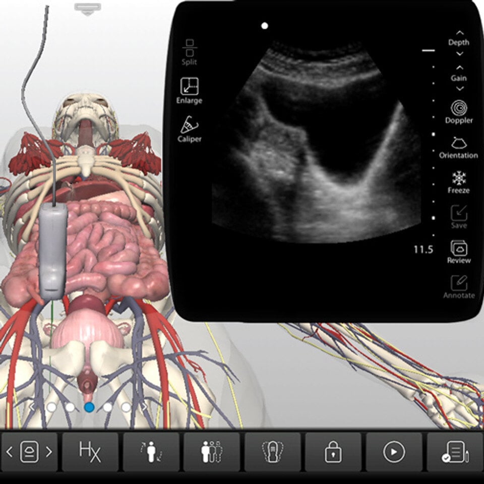 adv_normal_adnexa_case_screen__72291 adv_normal_adnexa_case_screen__72291