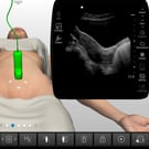 GYN Ultrasound of Nonpregnant Normal Uterus