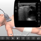 Pediatric Lung Sonography