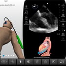 Resuscitative Transesophageal Echocardiography (TEE)