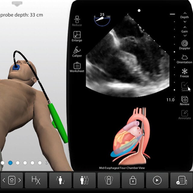 adv_tee_case_screen__17811 adv_tee_case_screen__17811