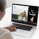 Resuscitative Transesophageal Echocardiography (TEE)