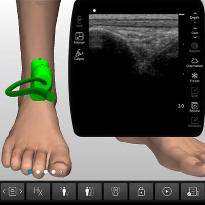 MSK Ultrasound Training