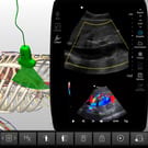 Aorta & Inferior Vena Cava (IVC)s
