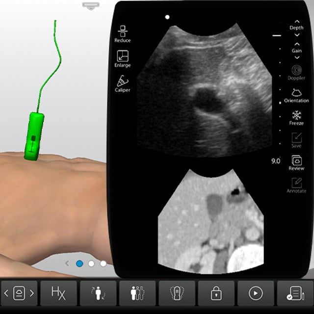 biliary_tree_case_screen__28458 biliary_tree_case_screen__28458