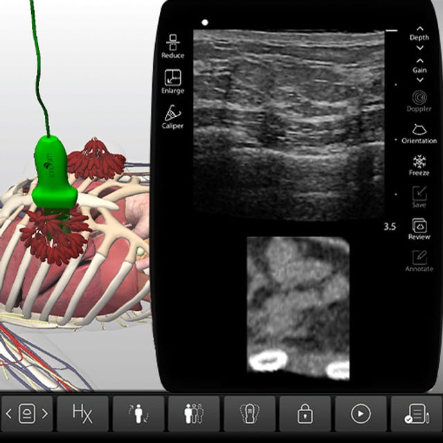 breast_case_screen__94946 breast_case_screen__94946