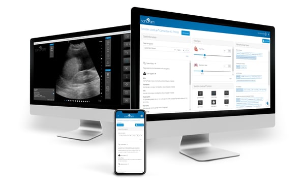 Use LiveScan on a laptop and CaseController on a mobile device for streamlined ultrasound simulation