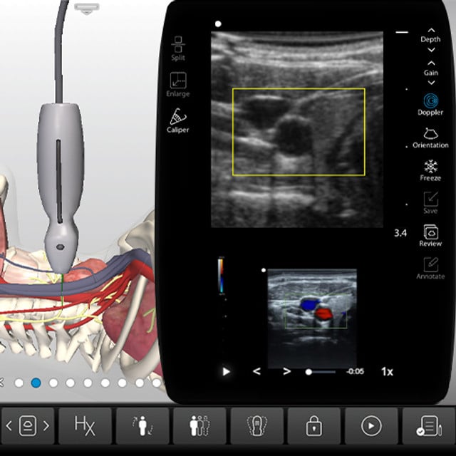 cerebrovascular_case_screen__24122 cerebrovascular_case_screen__24122