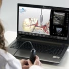 Cerebrovascular