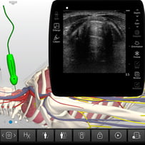Core Clinical Ultrasound Training | SonoSim