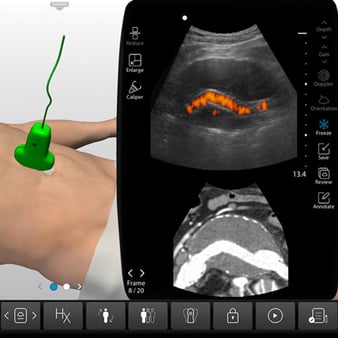 Core Clinical Ultrasound Training | SonoSim