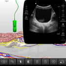 Bladder Clinical