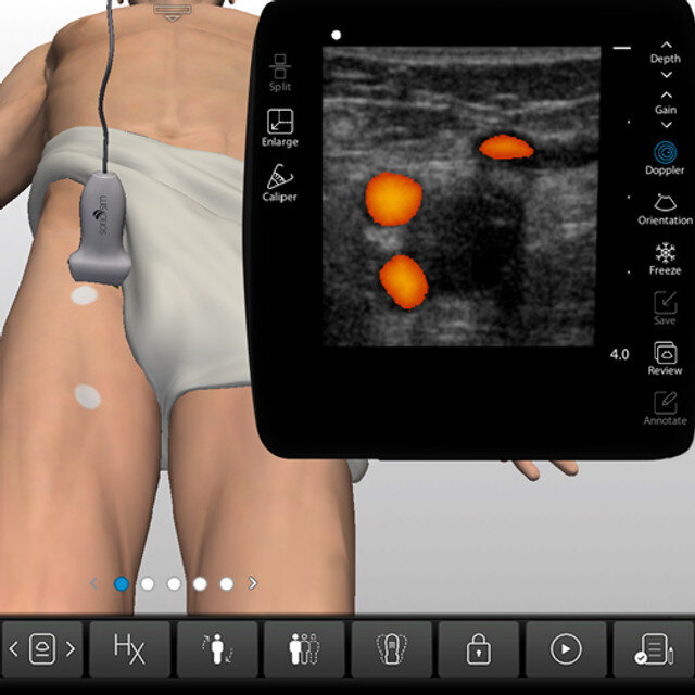clinical_dvt_case_screen__26957 clinical_dvt_case_screen__26957