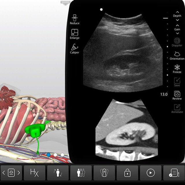 clinical_efast_case_screen__58772