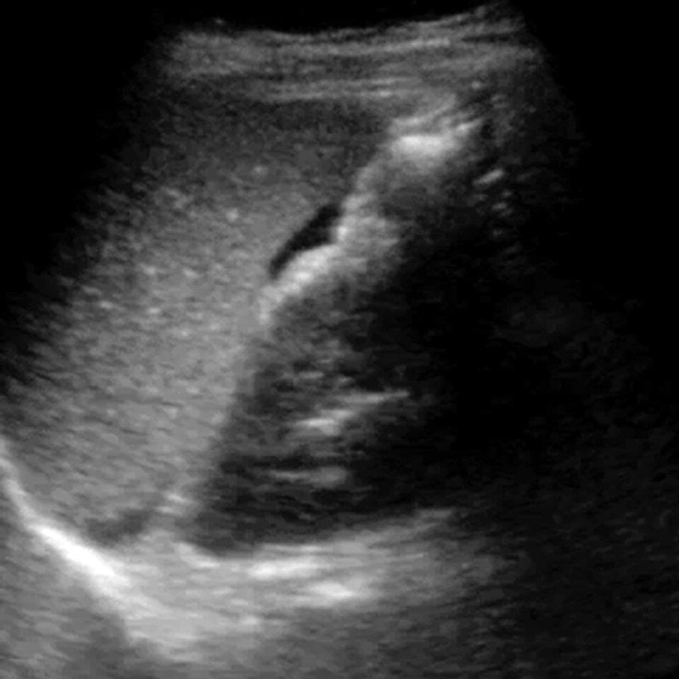 clinical_efast_ultrasound__65122-1
