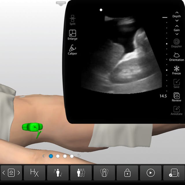 clinical_fast_case_screen__76216 clinical_fast_case_screen__76216