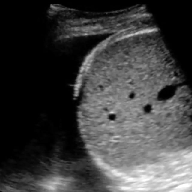 clinical_fast_ultrasound__02479