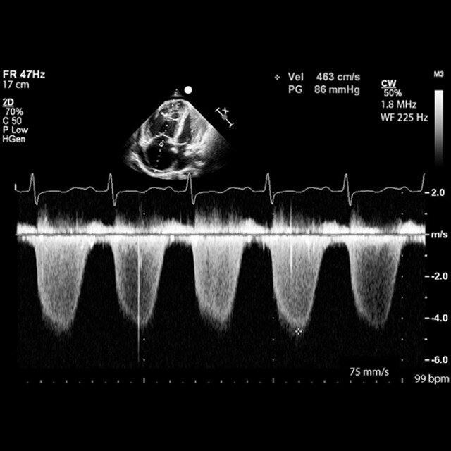 clinical_fundamentals_ultrasound__23551