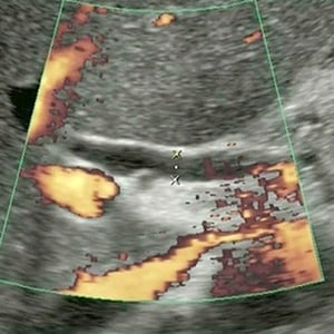 clinical_intestinal_ultrasound__76457