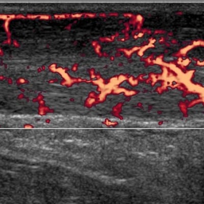 Clinical MSK ultrasound image Clinical MSK ultrasound image