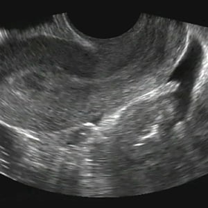 clinical_obgyn_ultrasound