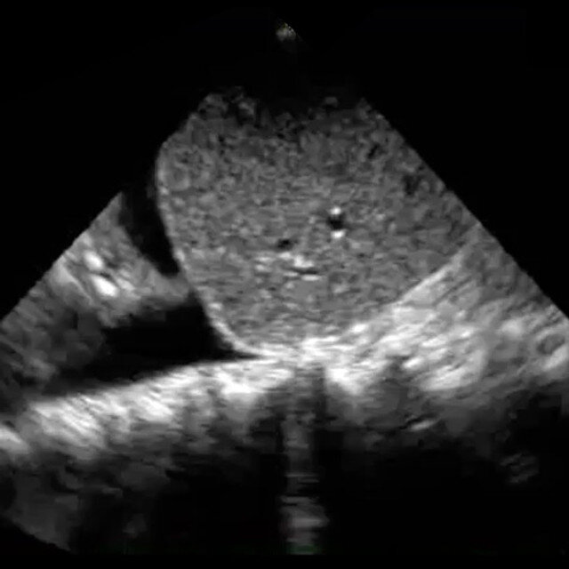 clinical_pulmonary_ultrasound__76351