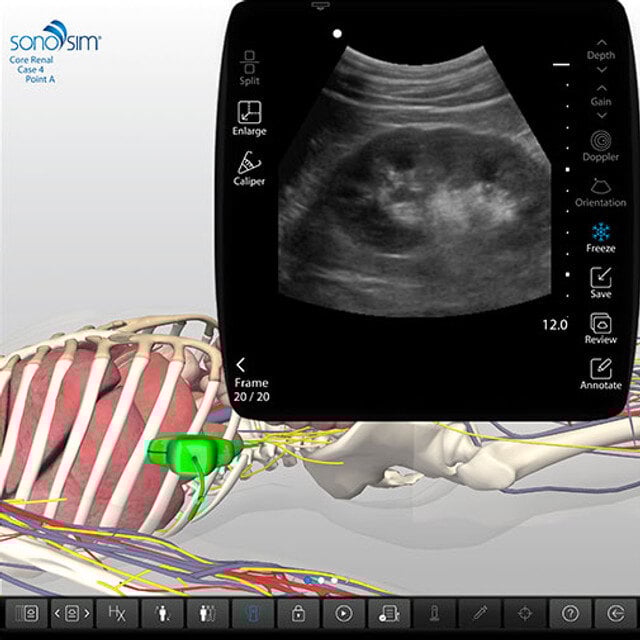 clinical_renal_case_screen_02__02011 clinical_renal_case_screen_02__02011