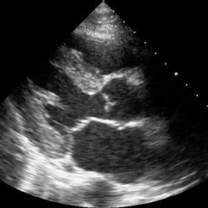clinical_rush_ultrasound clinical_rush_ultrasound