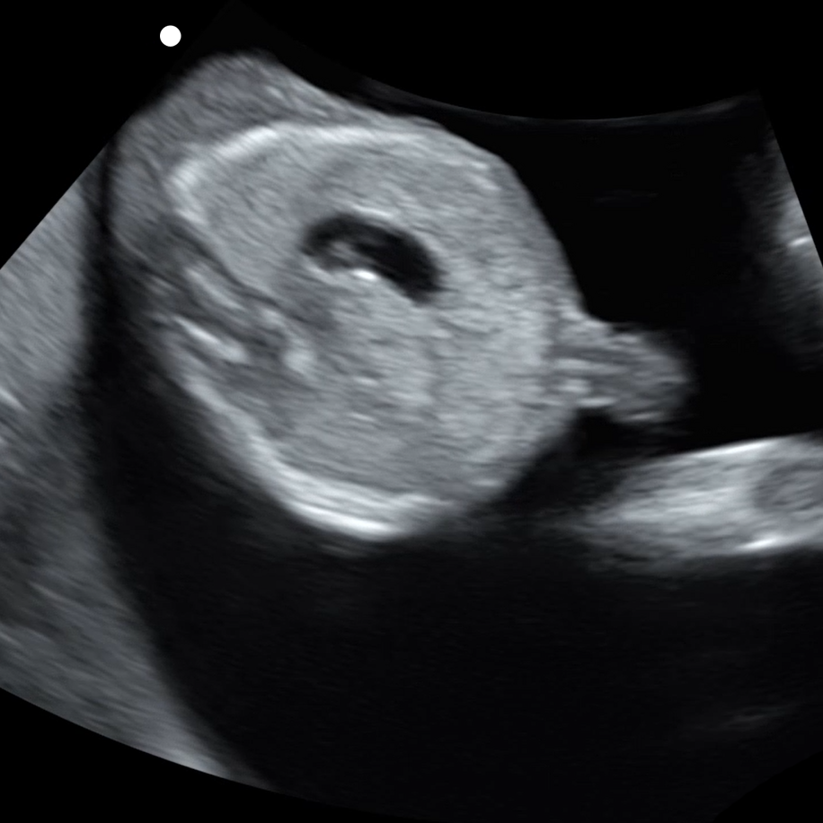 dms_detailed_fetal_abdomen_protocol