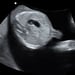 DMS fetal abdomen protocol