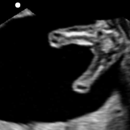dms_detailed_fetal_biometry_protocol